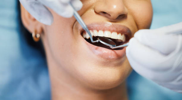 Best Emergency Dental Care for Broken or Chipped Teeth in Grambling, LA